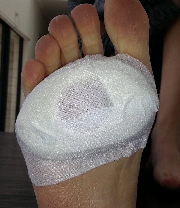 Close up of a foot with the ball covered in white medical tape